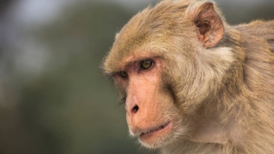 Primer muerto por Viruela del Mono en América