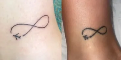 Se hizo un tatuaje en las vacaciones y se arrepintió