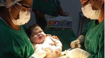 Nació un superbebé de más de 7 kilos y rompió un récord