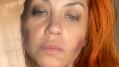 Preocupante video de Lourdes de Bandana: "Volví al maltrato"