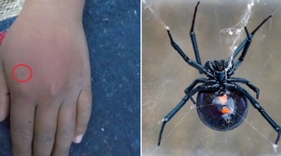 Un nene de 8 años se dejó picar por una araña "para ser Spider-Man": quedó internado