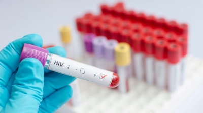 Día Nacional de la Prueba del VIH: Testeos gratuitos en Buenos Aires