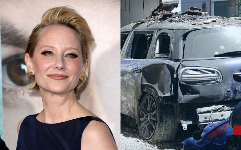 Anne Heche chocó contra una casa y provocó un incendio