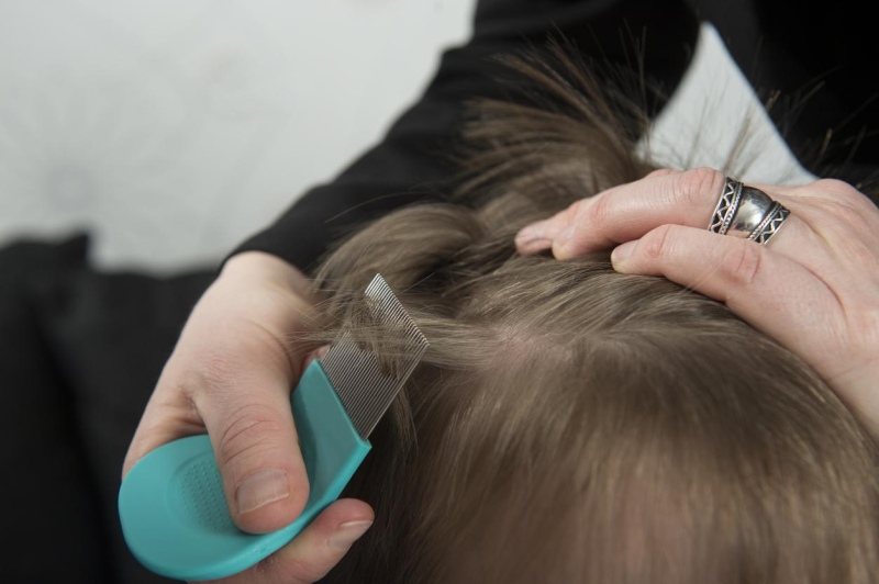 Se ofrece a sacar piojos para poder llegar a fin de mes