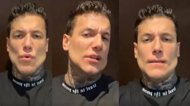 Alex Caniggia se hizo unos retoques en la cara