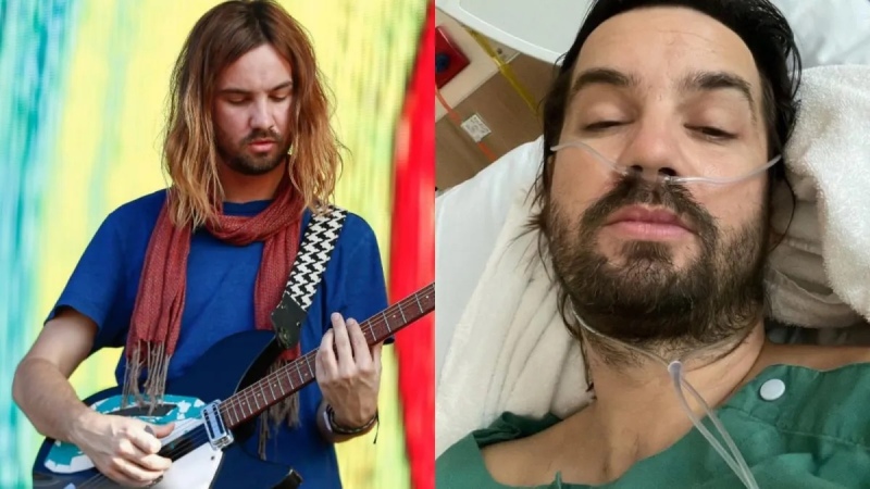 El líder de Tame Impala se lesionó previo al Lollapalooza Argentina