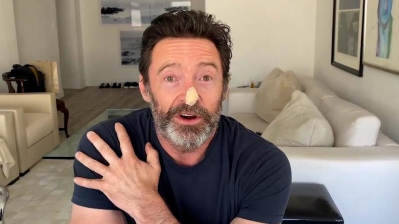 Hugh Jackman se sometió a dos biopsias por el riesgo de cáncer de piel