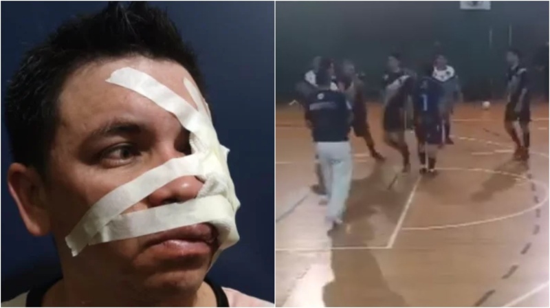 Tremendo video: Le rompieron la mandíbula de un cabezazo en un partido de Futsal